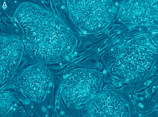Pluripotencjalne komórki macierzyste w medycynie regeneracyjnej