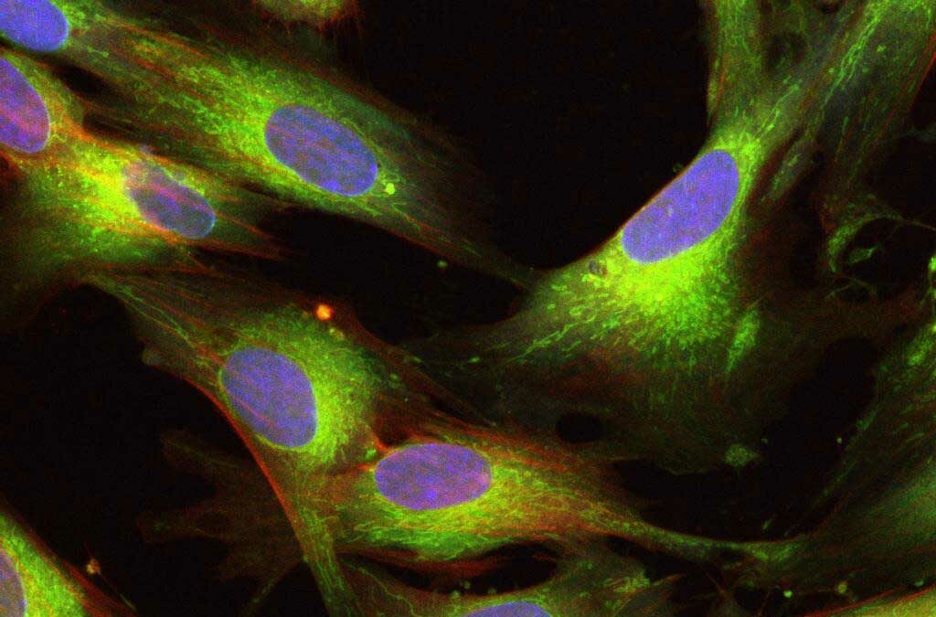 Komórki macierzyste-UCMSC