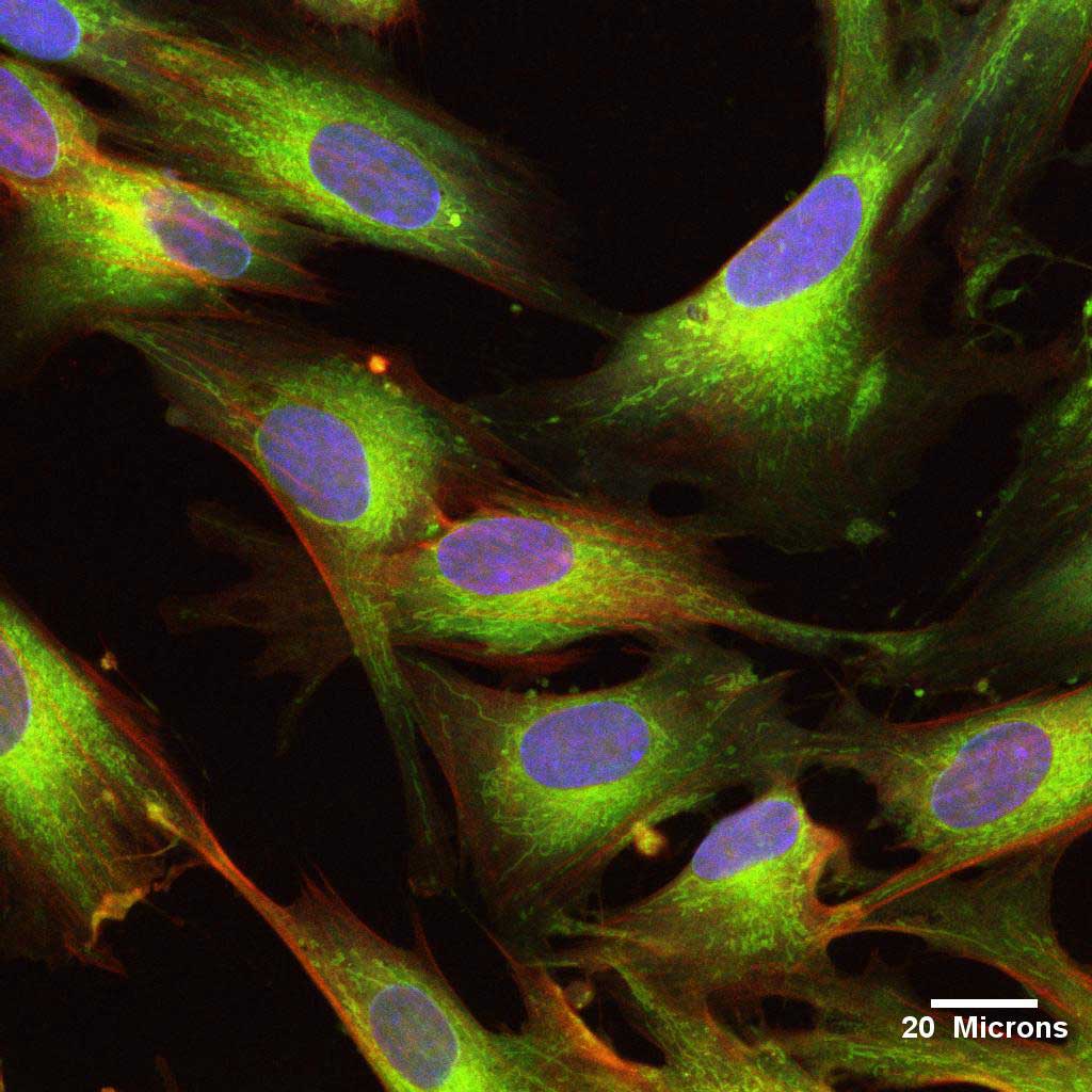 Mezenchymalne komórki macierzyste z pępowiny (UCMSC)
