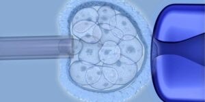 Stem cell therapy -