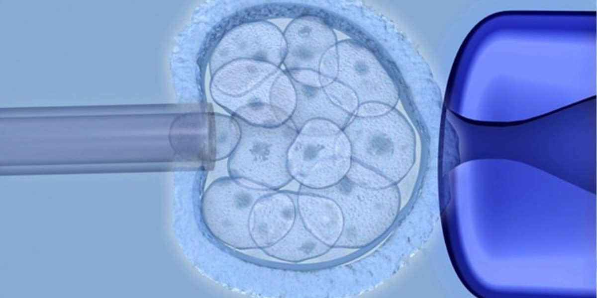 Embrionalna terapia komórkami macierzystymi