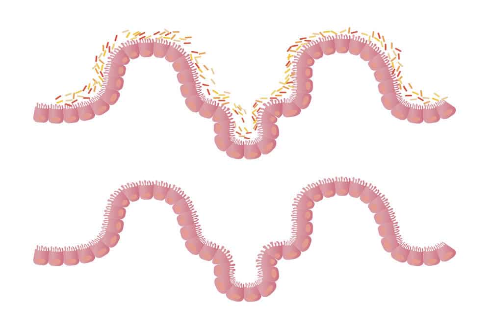 Przeszczep Mikrobioty Jelitowej (FMT)